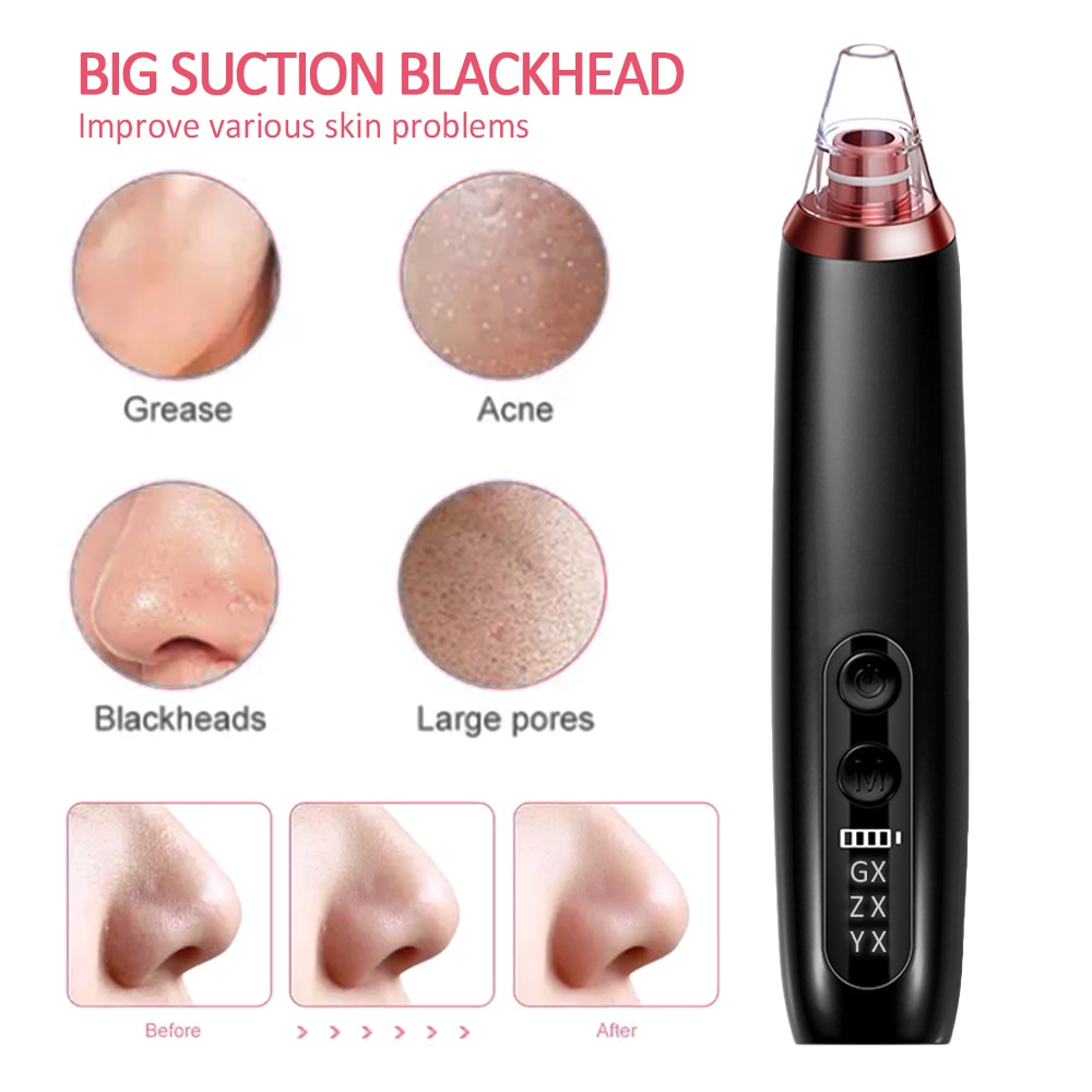 Blackhead Remover tool Face Acne Black head Dot Pimple Electric Microcrystalline Vacuum Cleaner Pore Blackhead Skin Care Machine