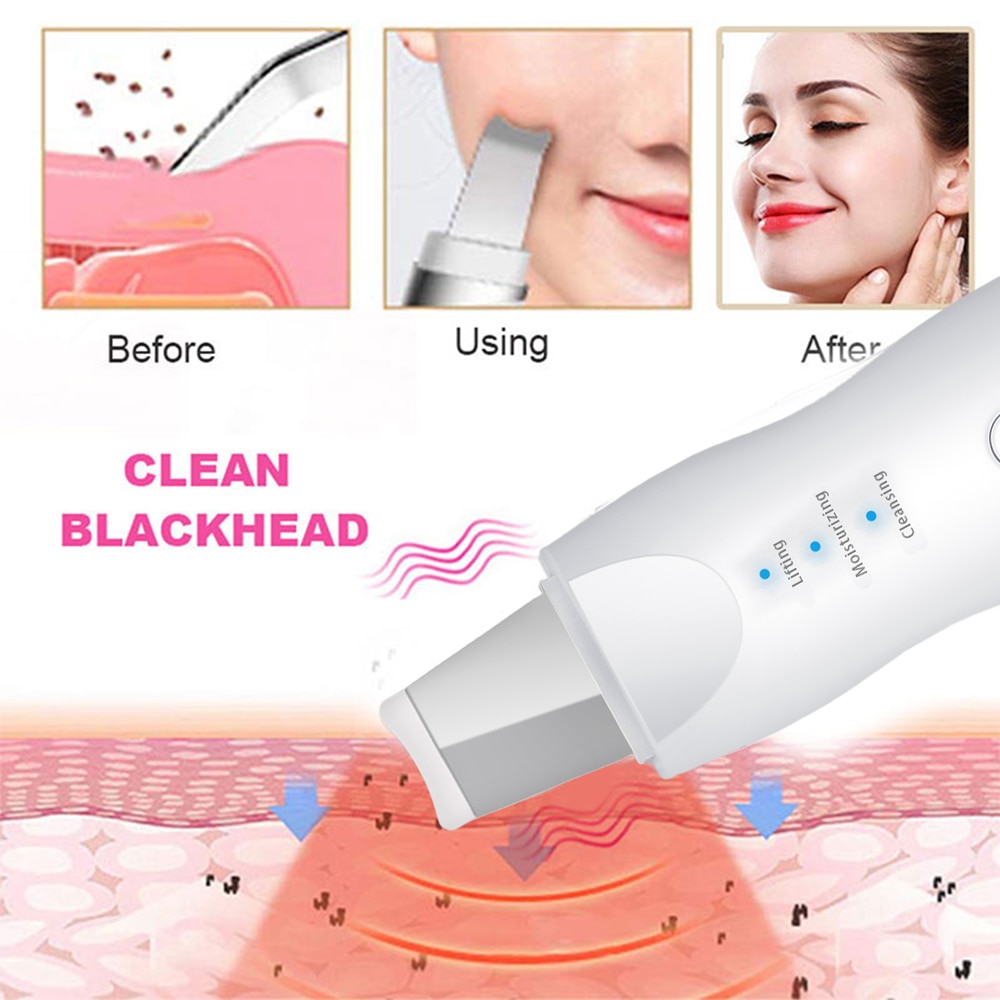 Blackhead Remover Vacuum Skin Scrubber Facial Cleansing Peeling Machine Pore Cleaner Facial Steamer Acne Remover Skin Care Tool