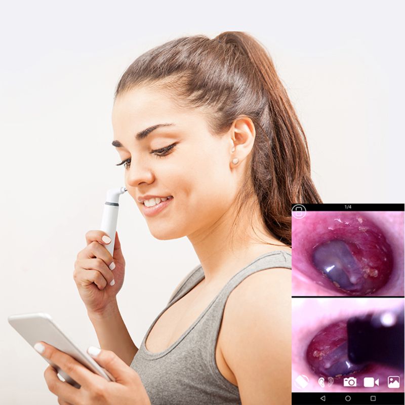 5 in1 3.9mm Wifi Earscope Cleaner Ear Endoscope Camrea 1080p Ear Spoon Earpick Otoscope for -Android -IOS iPhone