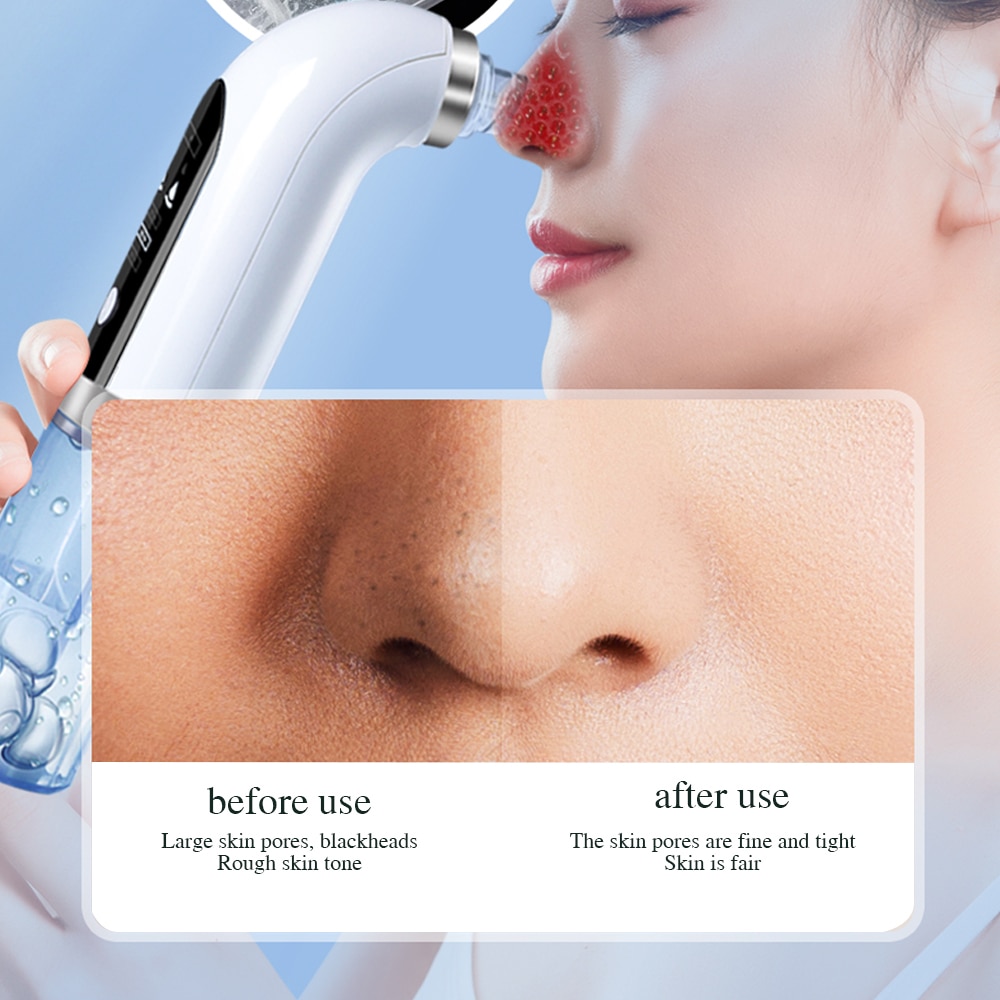 Electric Small Bubble Blackhead Remover USB Rechargeable Water Cycle Pore Acne Pimple Removal Vacuum Suction Facial Cleaner Tool