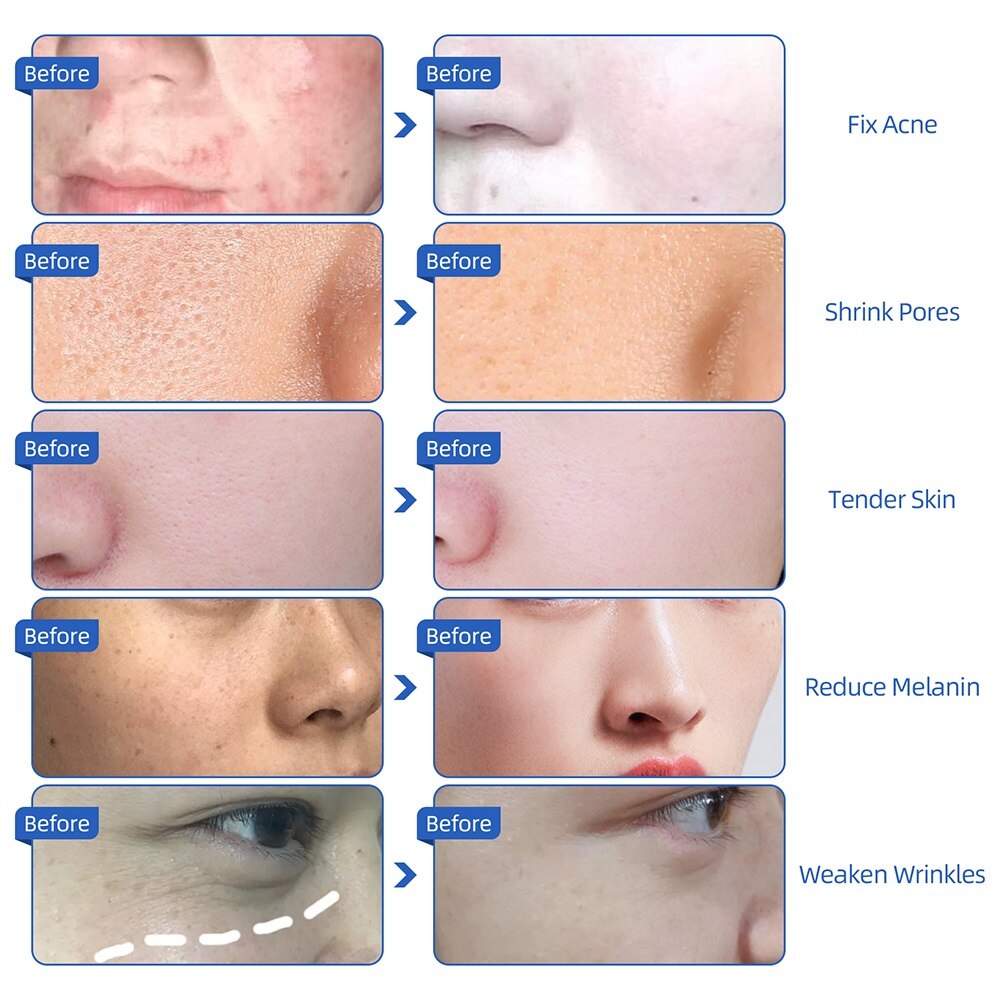 Korean 7 colors LED Facial Mask face mask Skin Care beauty Mask Photon Therapy Light Skin Rejuvenation Facial PDT Instrument