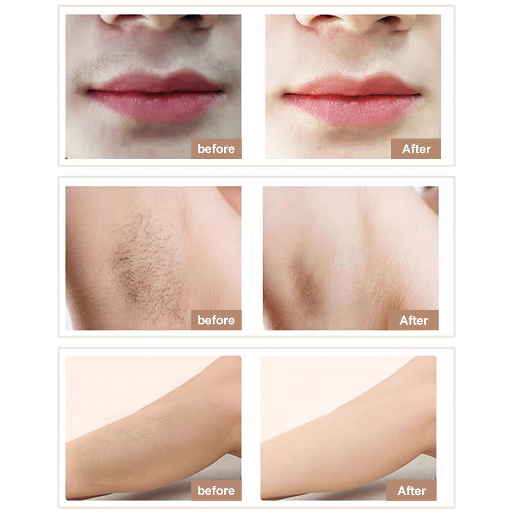 990000 Flash IPL Laser Hair Removal Machine Perasmanent LCD Epilator Photoepilator Hair Remover Bikini Trimmer depilador a laser