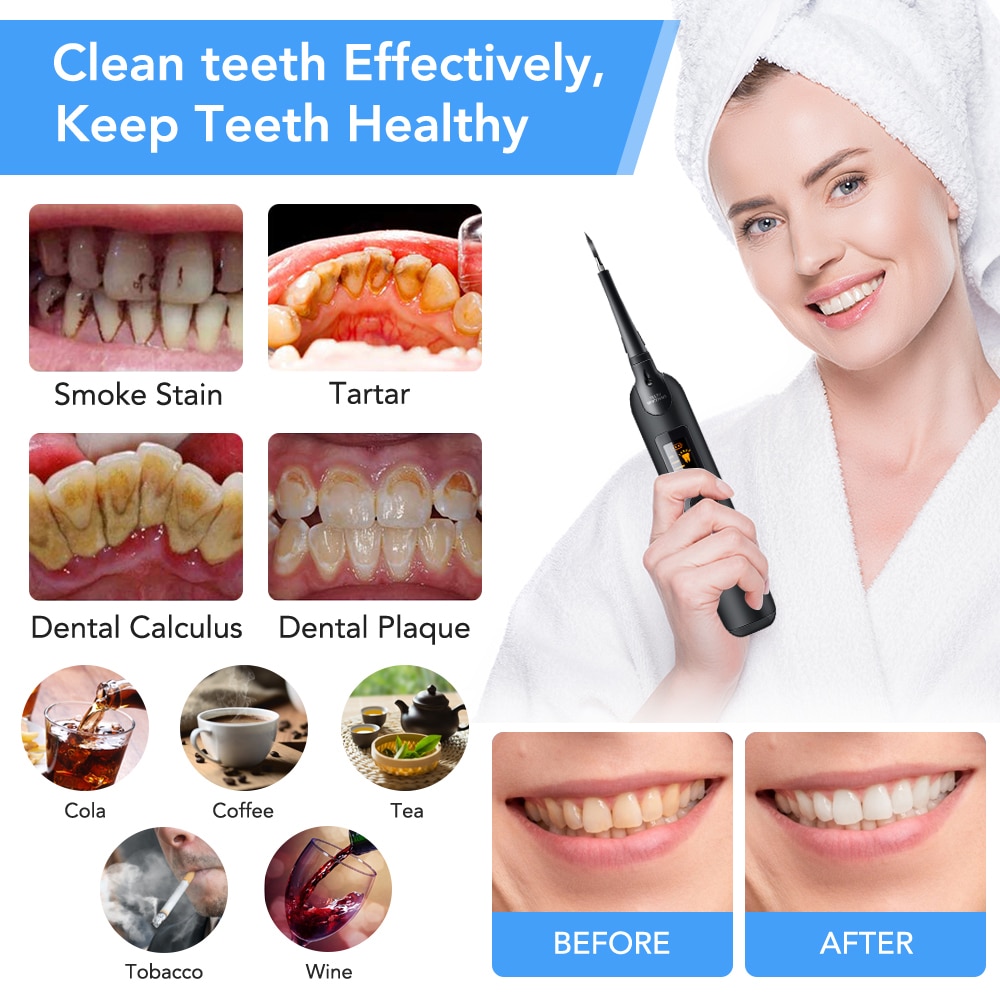 Electric Ultrasonic Sonic Dental Scaler LED Display Tooth Calculus Remover Cleaner Tooth Stains Tartar Tool Whiten Teeth Tartar