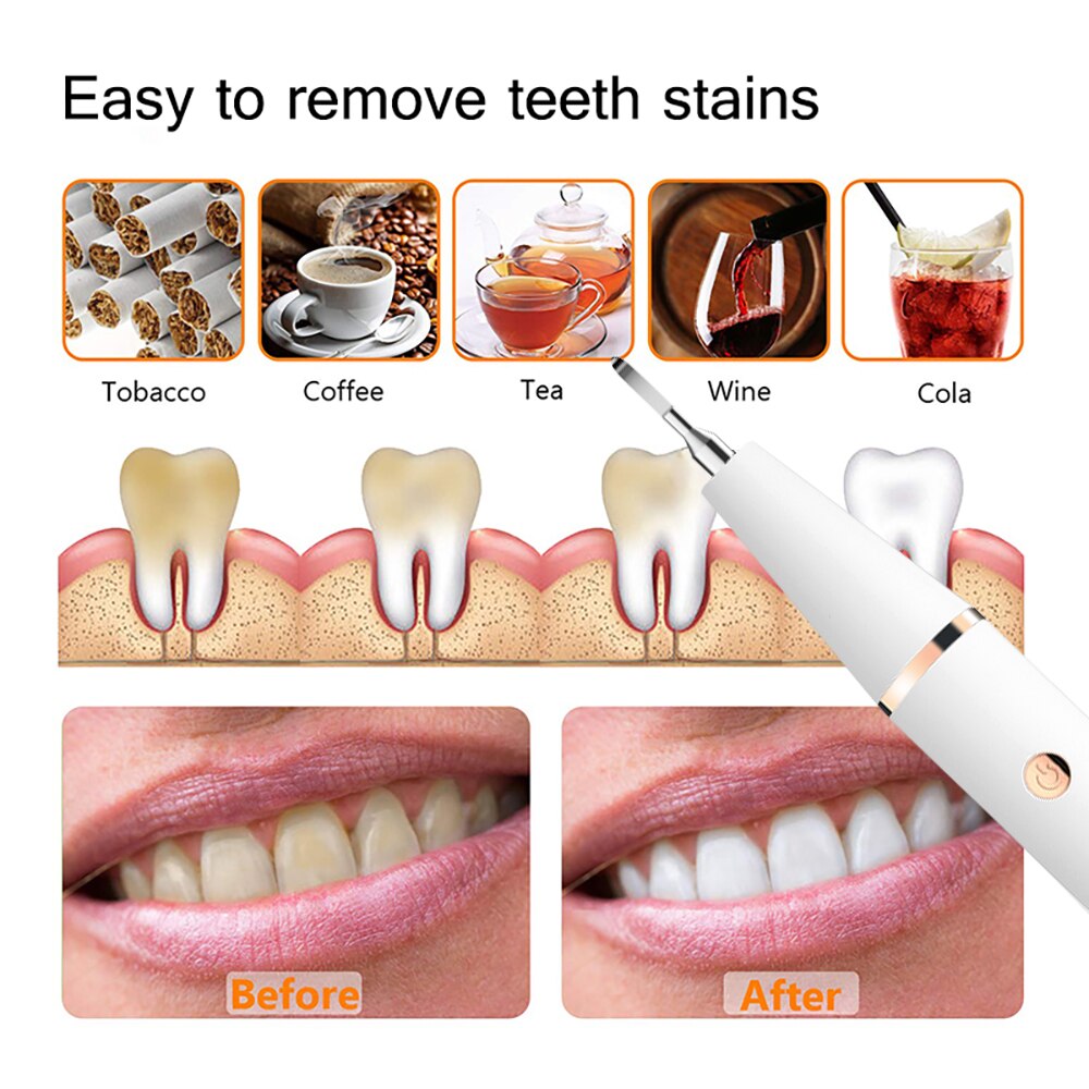 Dental Calculus Remover Endodontia Dental Led Ultrasound Teeth Cleaner Ultrasonic Toothbrush Electric Ultrasonic Sonic Tool Kit