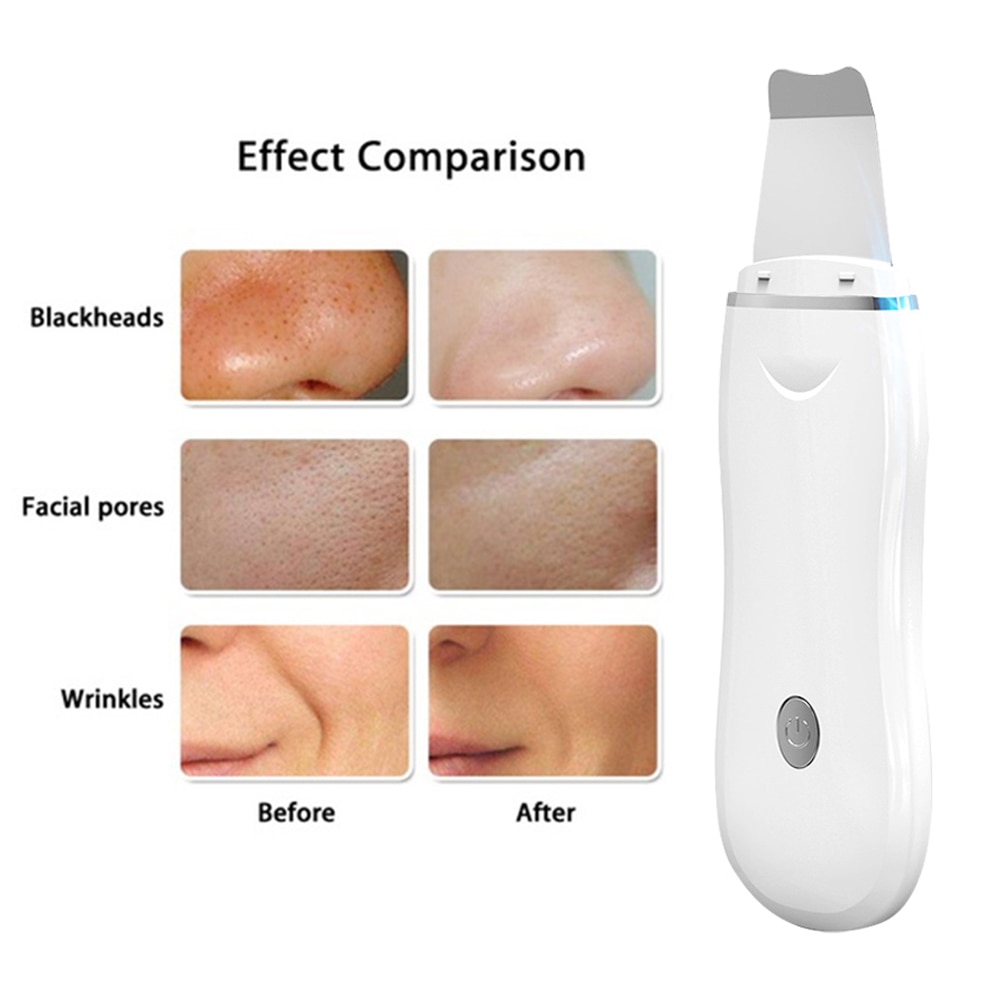 Ultrasonic Facial Skin Scrubber Cleaner Professional Face Lifting Peeling Extractor Deep Cleaning Beauty Device Mini Eye Massage
