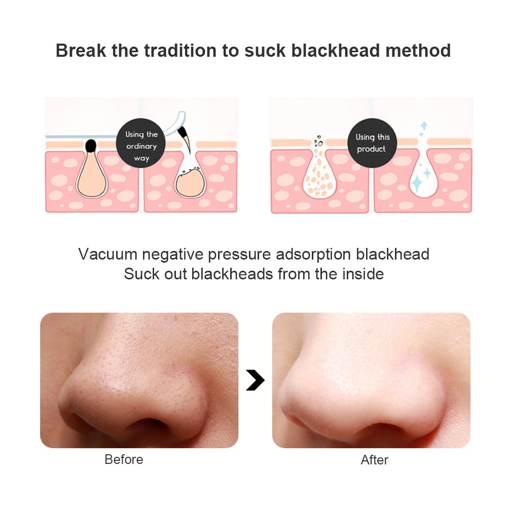 Ultrasonic Skin Scrubber Facial Pore Cleaner Ion Acne Blackhead Remover Peeling Shovel Cleaner Facial Massager Face Lift Machine