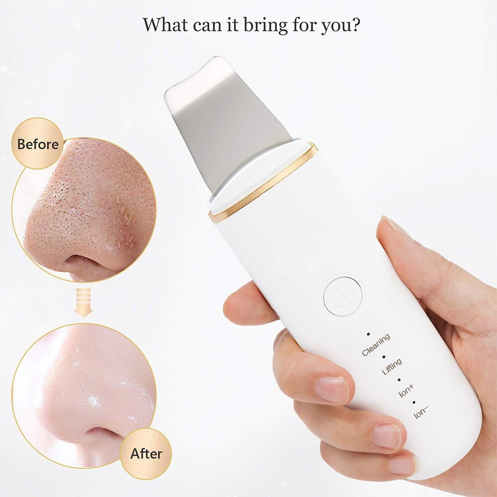 Ultrasonic Vibration Shoveling Machine Cleansing Device Pore Cleansing Facial Skin Lifter Skin Cleaner Deep Cleansing Peeling