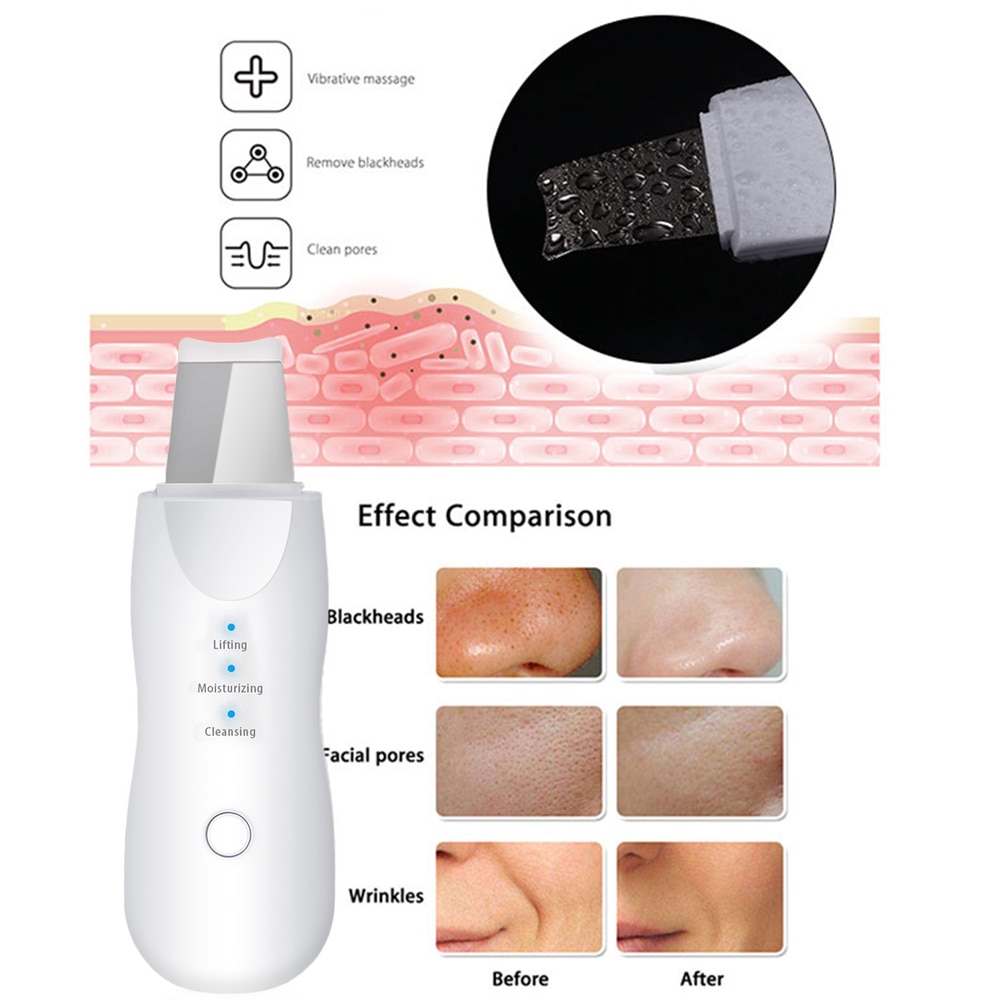 Vibrate Deep Face Cleaning Skin Scrubber Remove Dirt Blackhead Reduce Wrinkles Facial Lifting Peeling Tool Not Ultrasonic Shovel