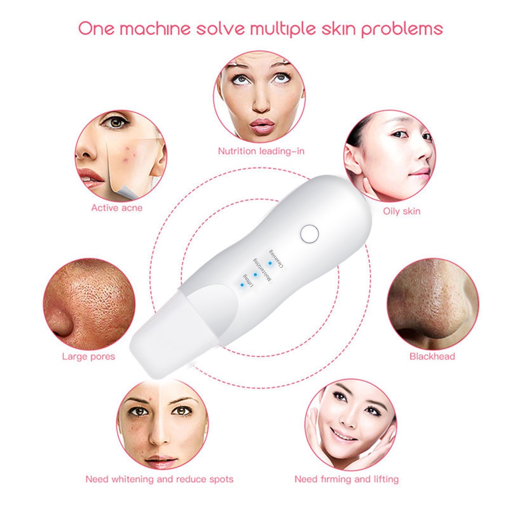Vibrate Deep Face Cleaning Skin Scrubber Remove Dirt Blackhead Reduce Wrinkles Facial Lifting Peeling Tool Not Ultrasonic Shovel