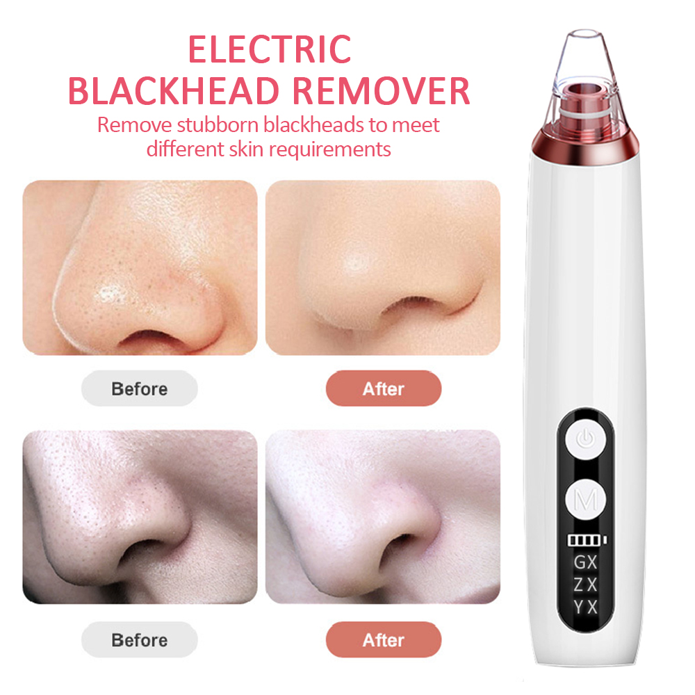 Blackhead Remover tool