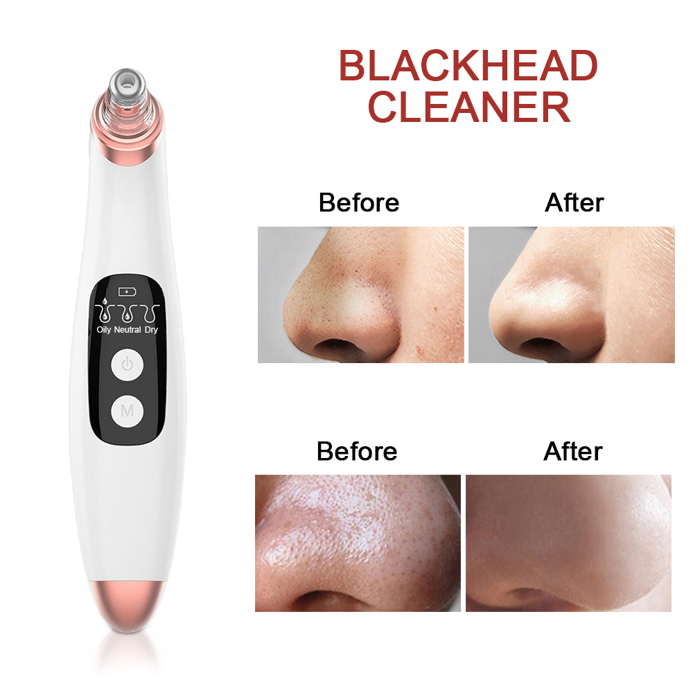 Electric Acne Blackhead Remover 