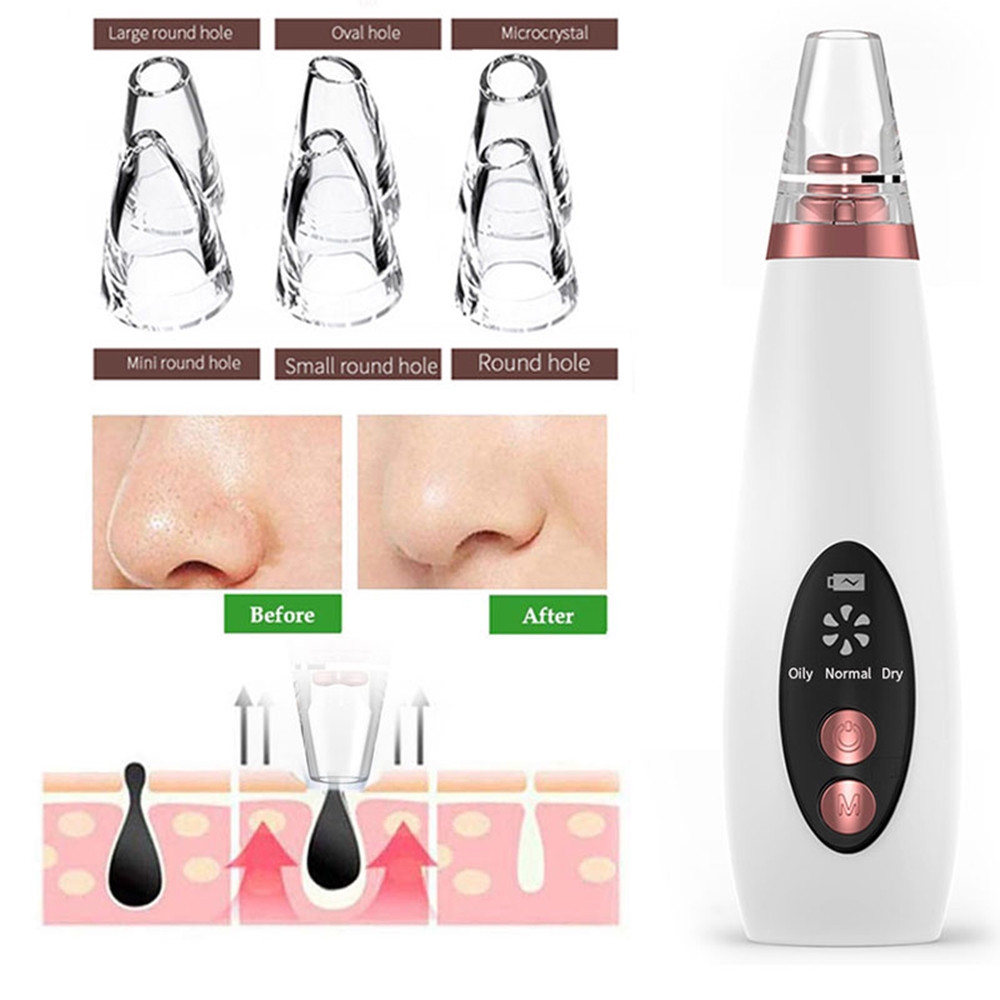 Electric Acne Blackhead Remover 