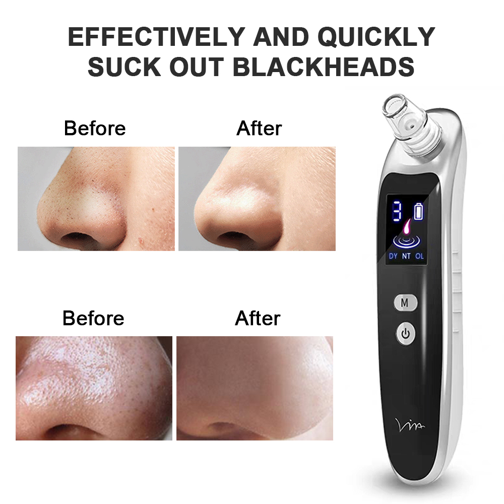 Electric Blackhead Remover 