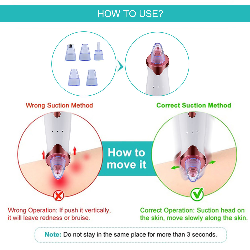 Electric Blackhead Remover