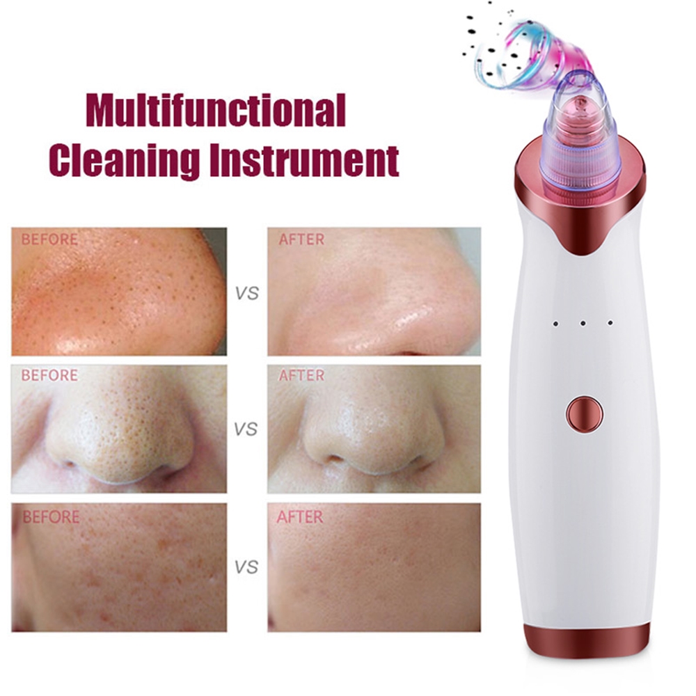 Electric Blackhead Remover