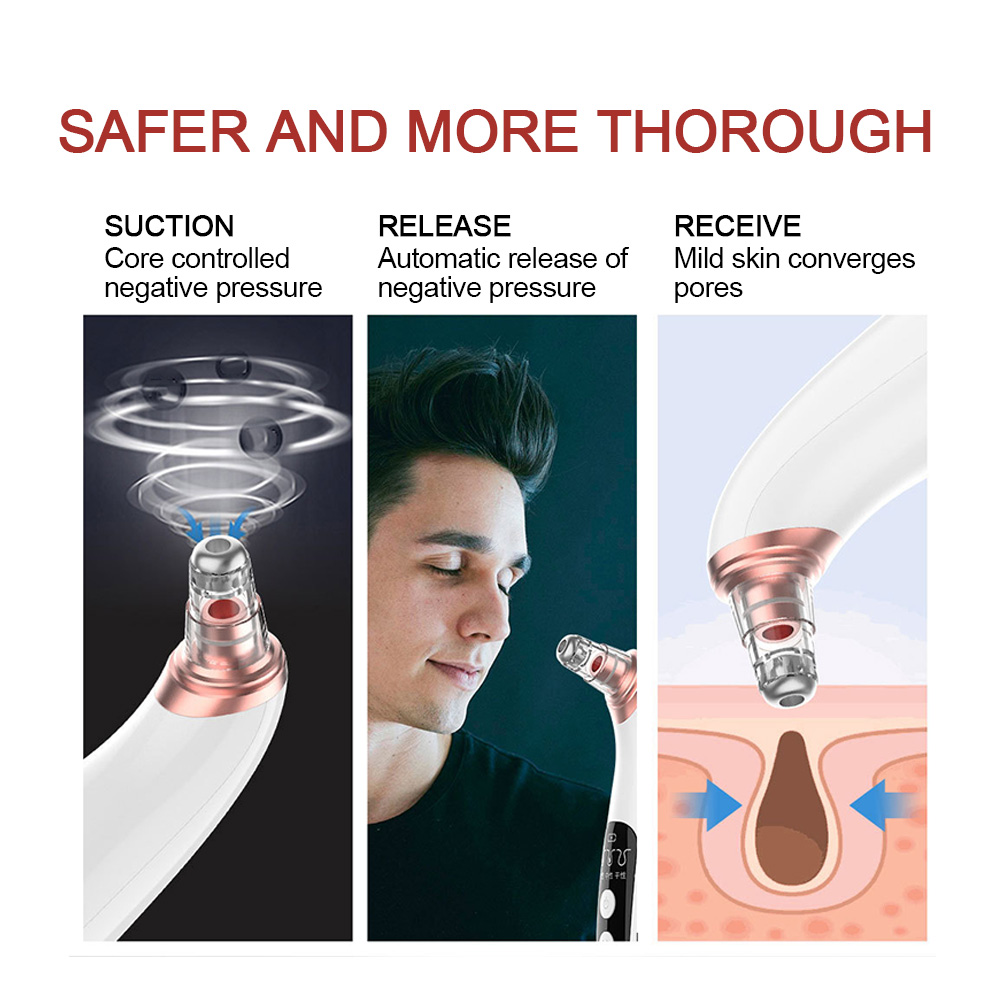 Electric Blackhead Remover