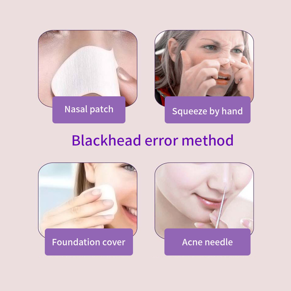 New Electric Facial Vacuum Blackhead Remover