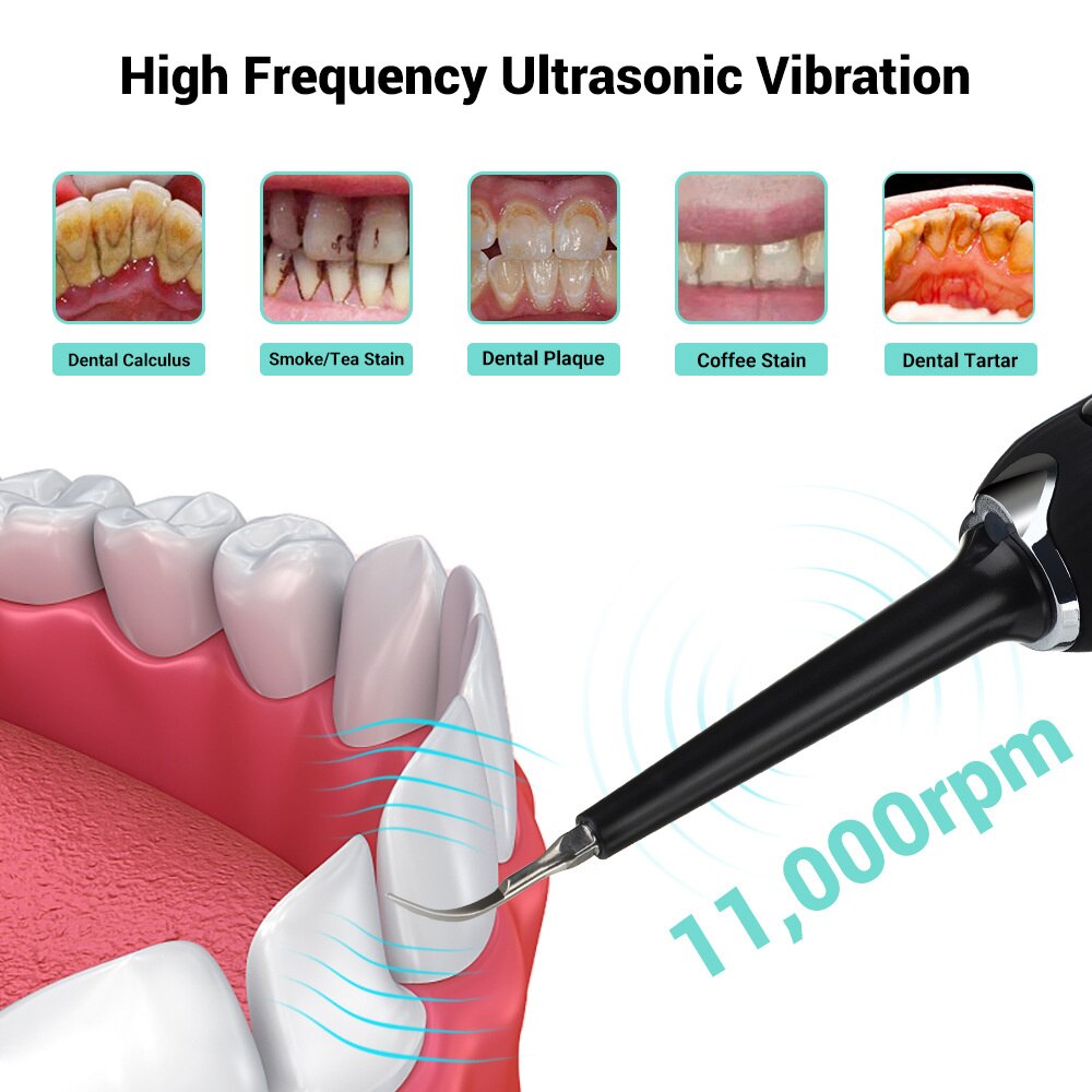 Portable Electric Sonic Dental Scale