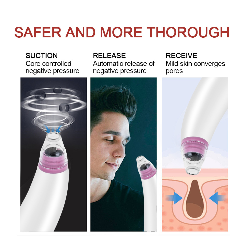 New Facial Blackhead Remover