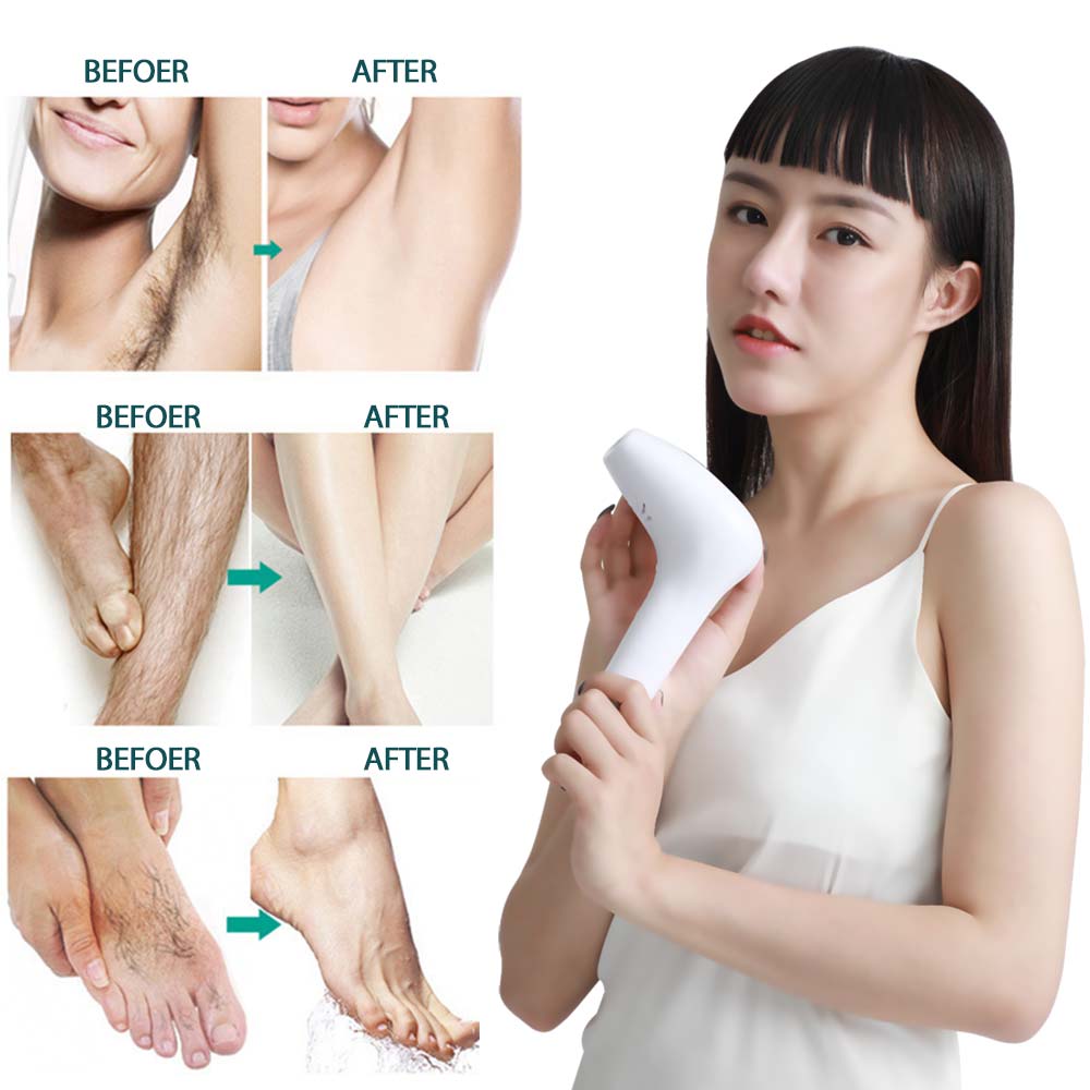 IPL Laser