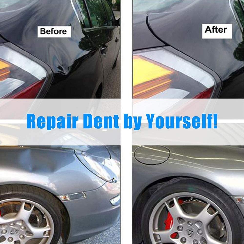Full Set Paintless Dent Repair Removal Hail Tool