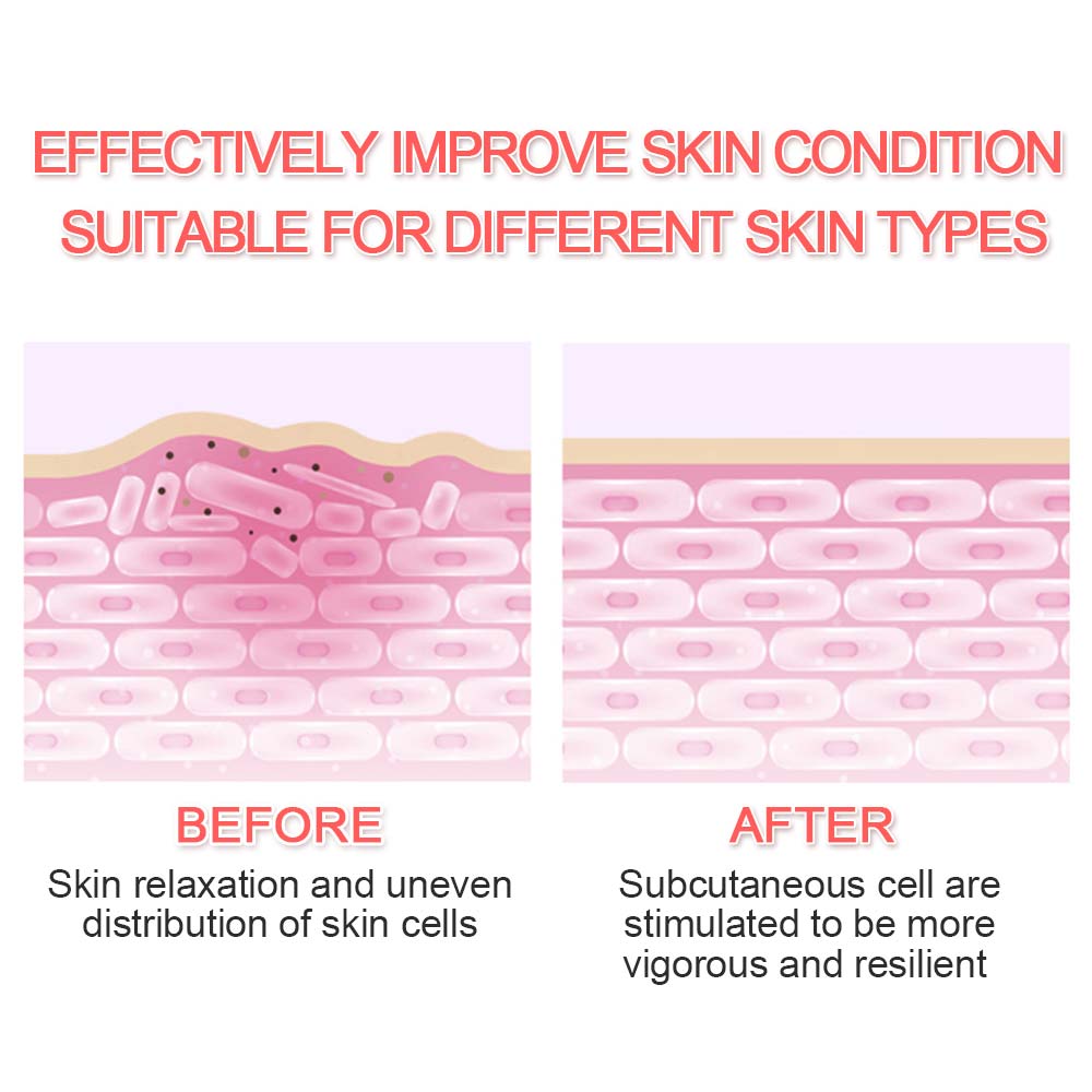 Ultrasoic Skin Scrubber 