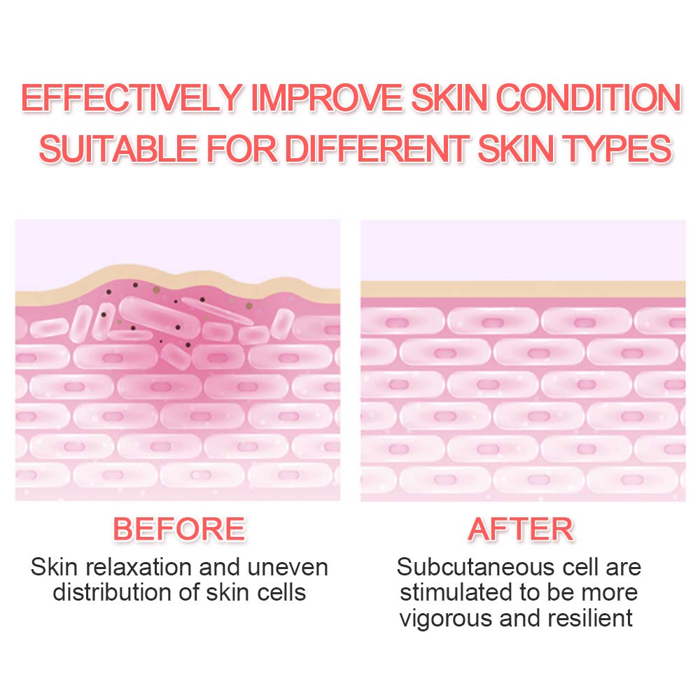 Ultrasoic Skin Scrubber