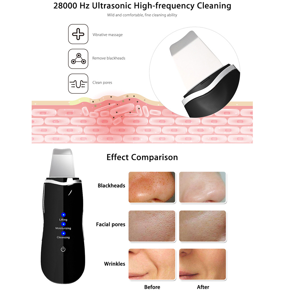 Ultrasoic Skin Scrubber 